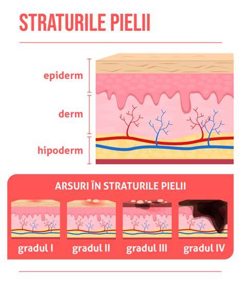 Diagramă cu straturi de piele la bebeluși versus adulți