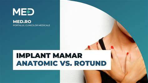 Infografic: Alegerea tipului de implant (rotund vs. anatomic) si moduri de plasare