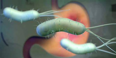 schemă infecție H. pylori și efecte asupra sarcinii
