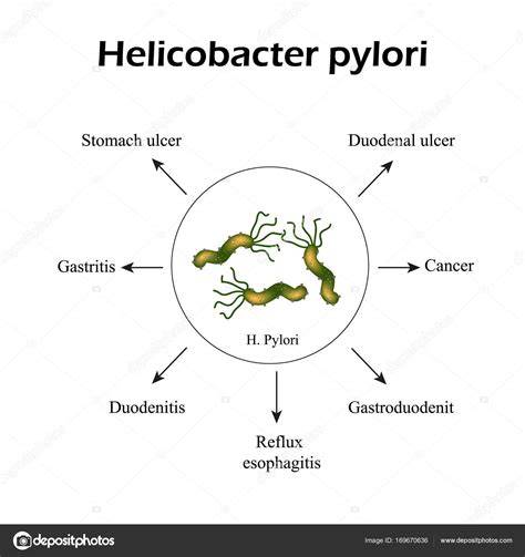 infografic tratamente H. pylori și siguranța în sarcină