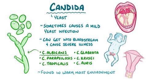 Diagrama mecanism Candida in vagin si optiuni tratament topice