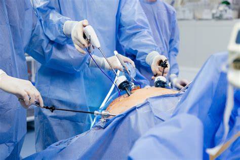 ChirurgiePediatrica_Laparoscopie