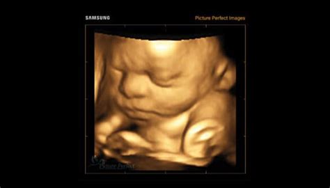 ecografie 3D clinica fertilitate