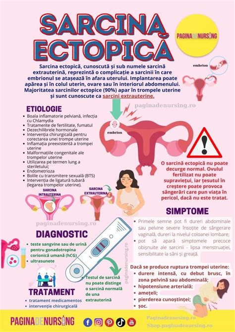 Infografic - identificare și pașii de diagnostic pentru sarcina ectopică
