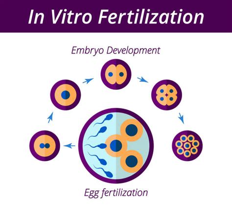 Schema procesului de fertilizare in vitro