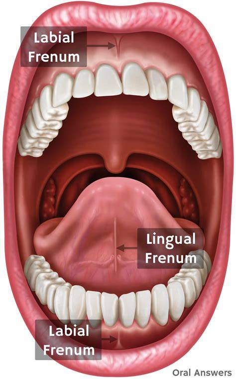 Imagine: structuri ale frenilor in cavitatea bucala: fren lingual, fren labial superior, fren labial inferior