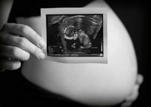 ecografie-morfologie-fetala
