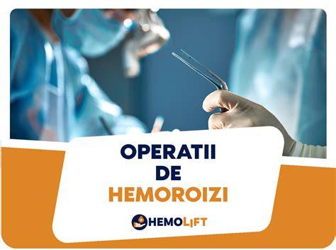 Diagrama tipuri Hemoroizi: interni, externi, tromboza