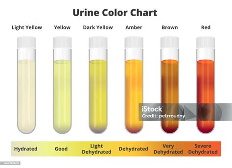 Diagrama comparativă a testelor de sarcină: urină vs. sânge