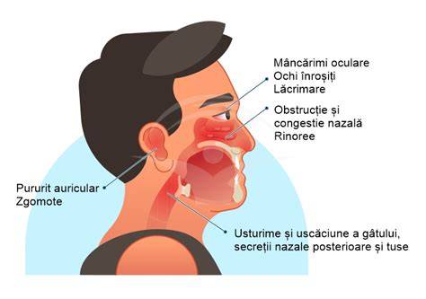 Scheme de tratament pentru rinita alergica: antihistaminice, corticosteroizi nazali, imunoterapie