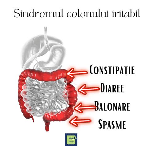 Infografic: Configurarea colonului și segmentele sale