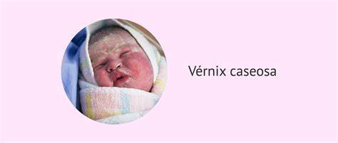 Vernix caseosa pe pielea fătului