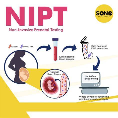 Schema decizională: Screening NIPT vs diagnostic invaziv