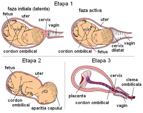 Diagrama etapelor travaliului: dilatarea, expulzia, nașterea
