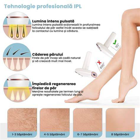 Legenda zonelor potrivite pentru epilare IPL dupa cezariană
