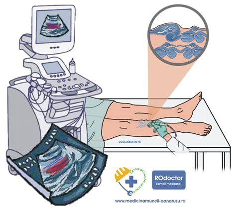 Diagrame: structură fetală și flux sangvin în ecografie Doppler