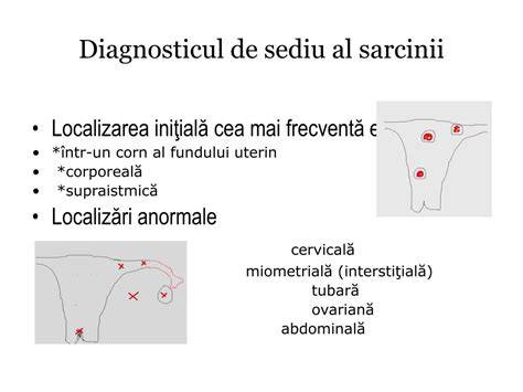 Infografic: etiologia, localizările obișnuite ale sarcinii ectopice și pașii diagnostici