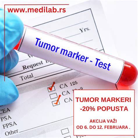 Schema screening trimestru I: markeri serici, NT, Dx
