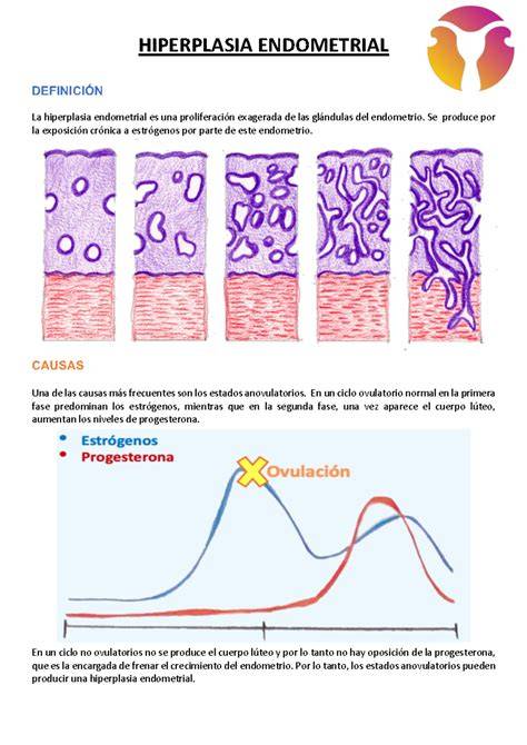 Infografie: etapele chiuretajului endometrial, de la pregătire până la recuperare