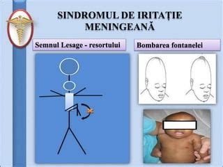 Ilustrație comparativă a fontanelei normale, bombate și înfundate