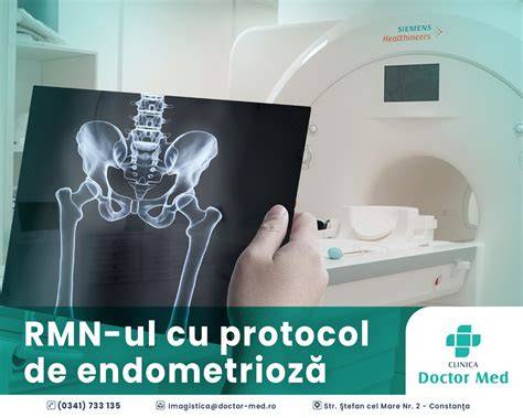 Imagine RMN endometrioză profundă: cartografierea leziunilor și relația cu organele vecine