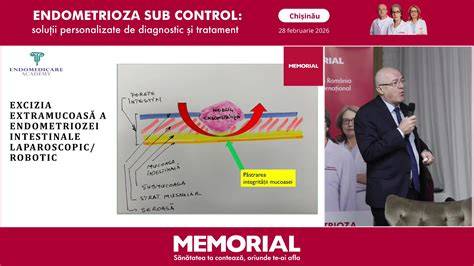 Diagramă a opțiunilor terapeutice pentru endometrioză: conservatoare vs. radicale