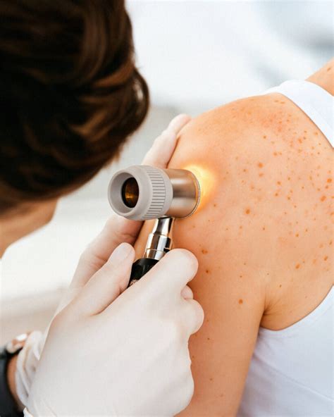 Dermatoscop pentru examinarea leziunilor cutanate