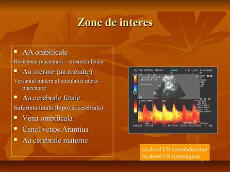 Diagramele de crestere fetala si monitorizarea Doppler a circulatiei