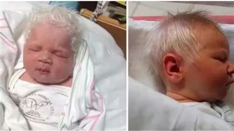 Fotografie cu bebelușul Bence născut cu păr alb