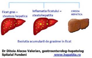 Infografic: cum se masoara ficatul la ecografie si schimbarile tipice ale ecogenicitatii in steatoza hepatica