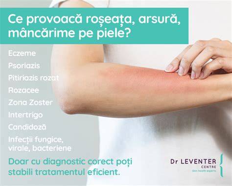 Infografic: Tipuri de afecțiuni ale pielii tratate în dermatologie
