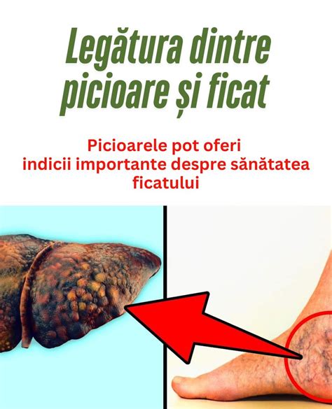 Piele fină și vase de sânge vizibile sub ochi