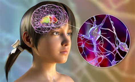 Ilustrație cu diferite tipuri de ticuri nervoase la copii