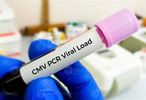 laborator-pcr-cmv-analiza