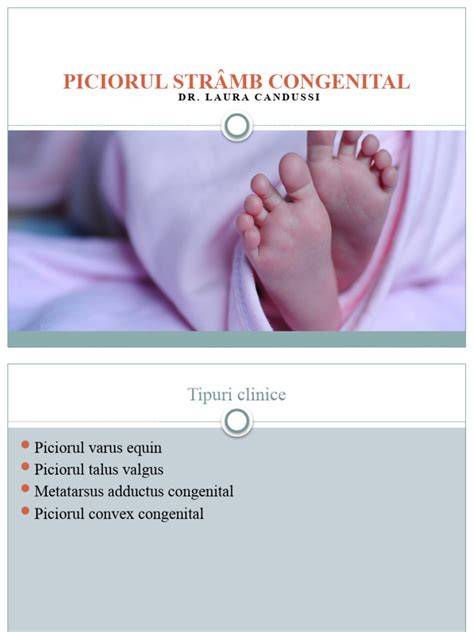 Infografic despre etapele tratamentului Ponseti pentru picior strâmb congenital