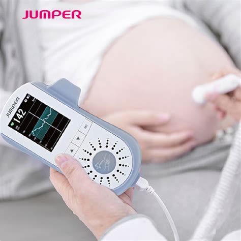 Schema de funcționare a unui doppler fetal