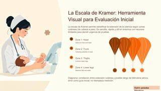 Diagrama Kramer - reprezentare vizuală a intensității icterului neonatal
