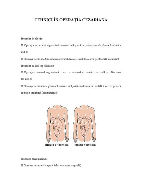 Schemă a inciziilor posibile în operația de cezariană
