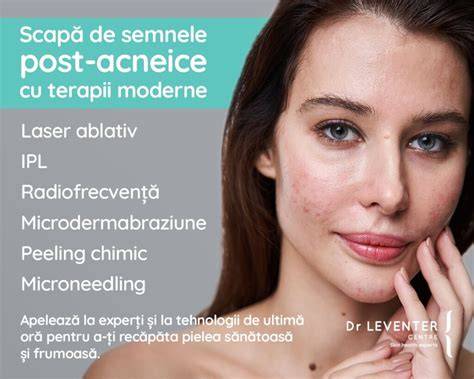 Infografic: ciclu de formare a leziunilor acneice și rolul sebaceelor
