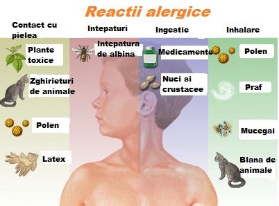 Infografic despre tipuri comune de alergii la copii