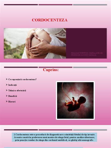 Diagramă: cordocenteza (PUBS) - ghidaj ultrasonografic
