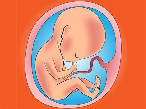 Infographic: etiologia chisturi cordon ombilical si relatie cu placenta accreta