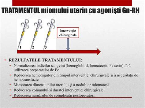 Infografic: Calea diagnosticului si a tratamentului chiuretajului uterin