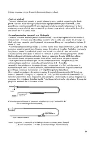 Diagramă a traseului cateterului în timpul cistografiei micționale