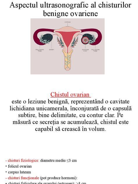 Infografic: Tipuri de chisturi ovariene și mecanismele de formare