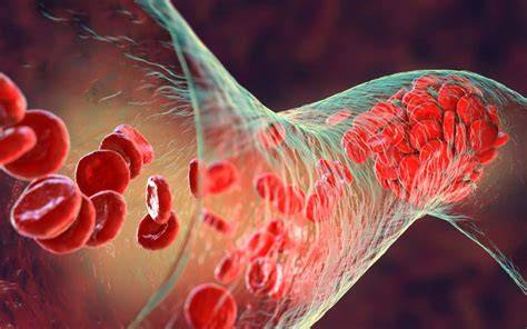 Infografic despre mecanismul hemostazei si formarea cheagurilor de sange