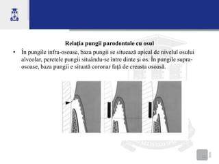 Infografic: structuri parodontale, pungile parodontale, tartru