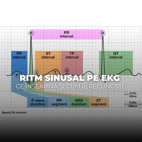 Infografic: Cum functioneaza nodul sinusal si cum apar PVC
