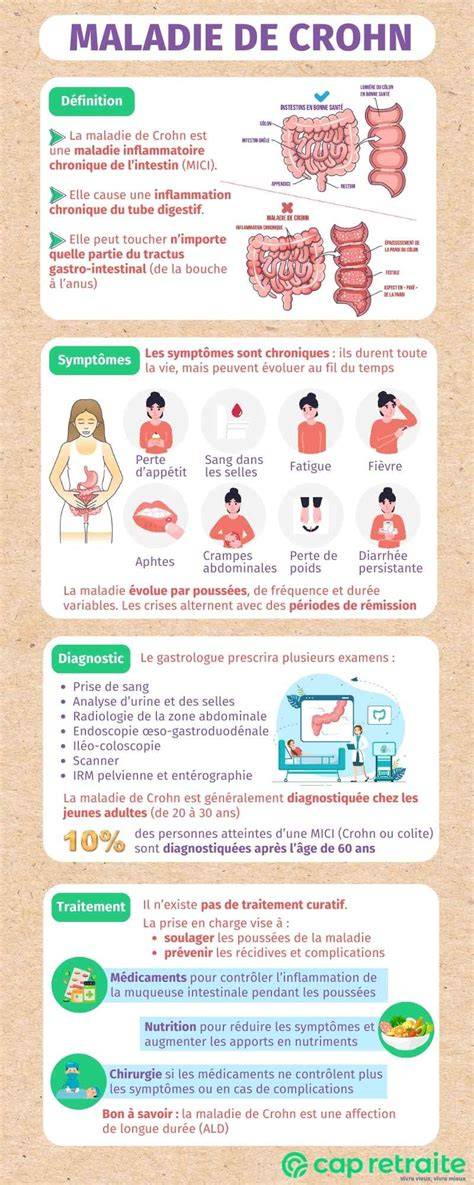 Infografic: traseu de diagnostic pentru Crohn si rolul colonoscopiei