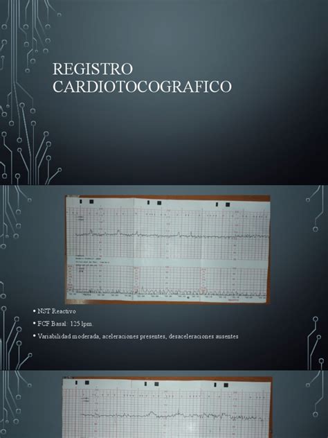 Grafic cardiotocografic